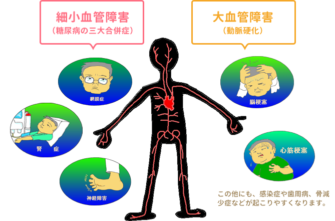 合併症